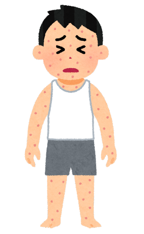 蕁麻疹がはやく良くなりました。