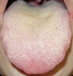 台風：人の体は小宇宙