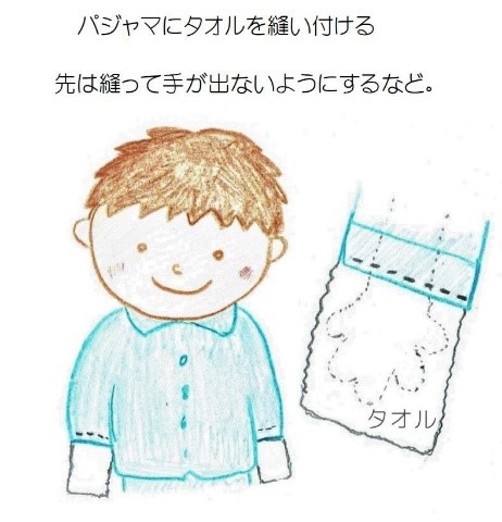 アトピー、掻かない工夫