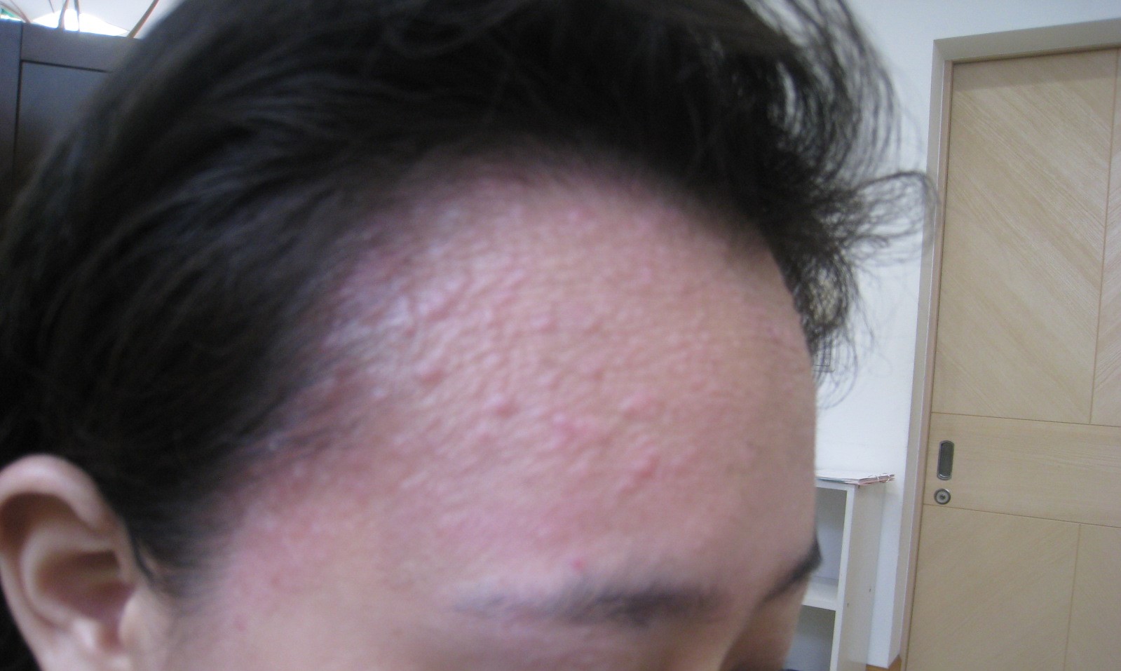 アトピーが改善し、成績アップ、お化粧もできるようになりました。