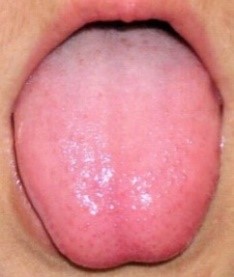 舌でわかるあなたの水分代謝