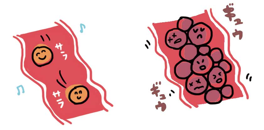 肩こり対策　１・瘀血(血行不良)タイプ