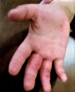 子供のアトピーと鼻炎も良くなりほっとしました。