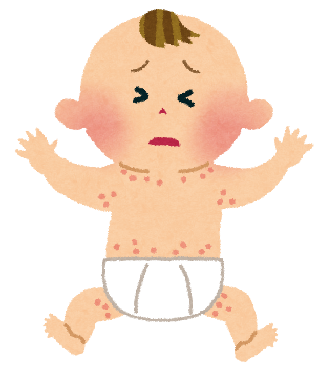 あせもと汗荒れの違いをご存知ですか？