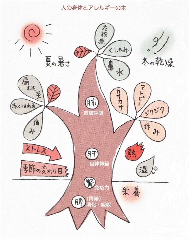 アトピー性皮膚炎：ステロイド軟膏を苦しまずにやめられる方法