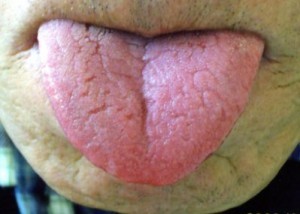 肺気腫の息苦しさがよくなり、神経痛もよくなりました！