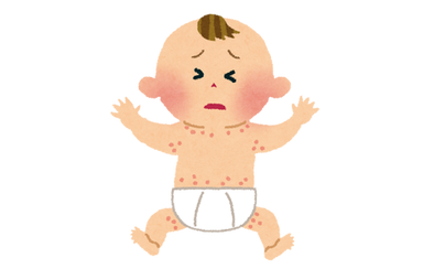 乳液でアトピー発症を抑えよう